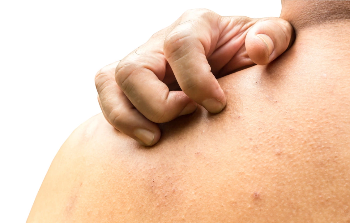 Doxepin for Itching: A Relief for Chronic Pruritus Sufferers
